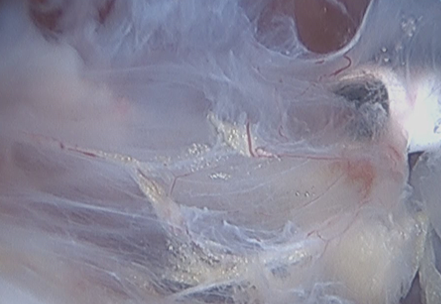 ファシアの画像(提供:B&Jクリニックお茶の水 洞口敬医師)